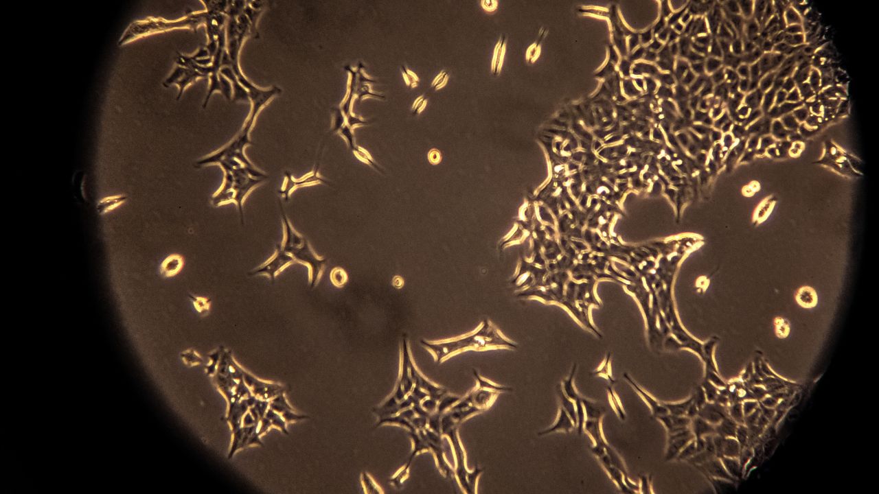 Come il DNA ereditato influisce lo sviluppo del tumore