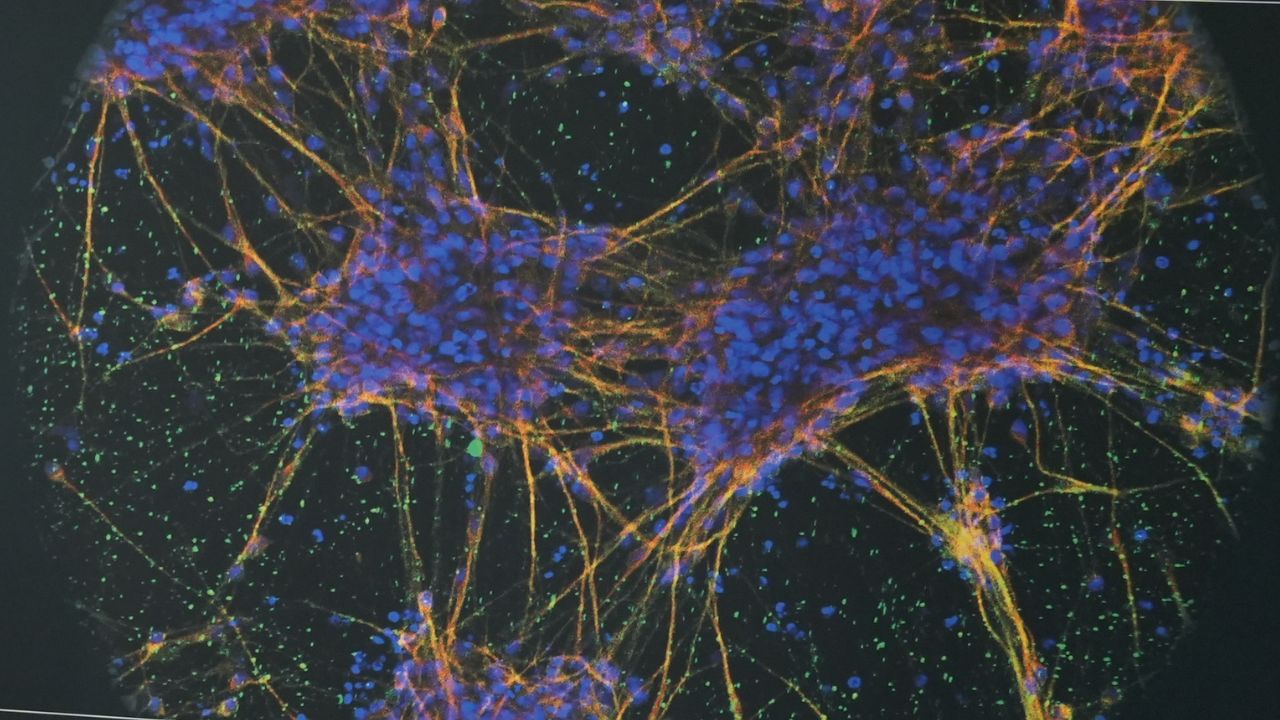Scoperte molecole con effetto sorprendente sul cervello