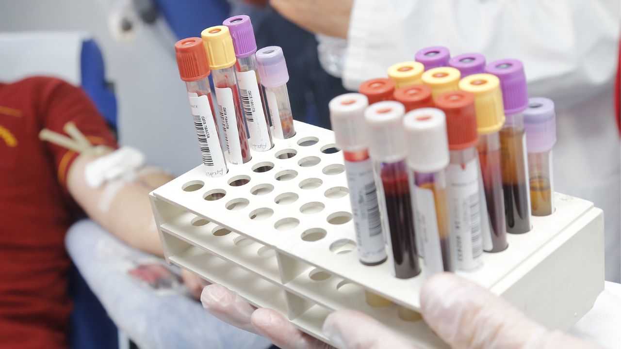 Donazioni di sangue e plasma in aumento: più coinvolti i giovani