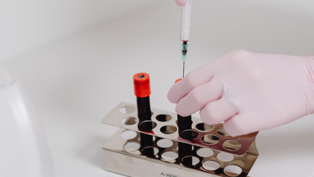 Cresce la raccolta di plasma in Italia ma ancora non è autosufficiente