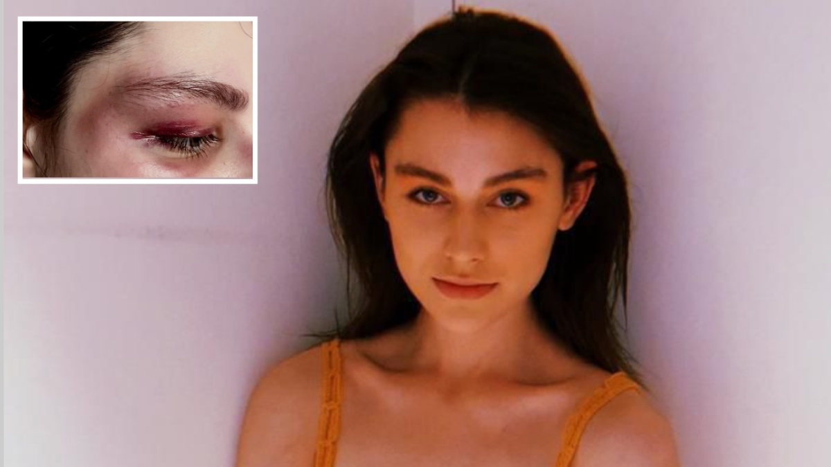 Milano, modella cerca il ragazzo che l’ha salvata dal branco: «Volevano violentarmi, è stato un eroe. Vorrei almeno dirgli grazie»