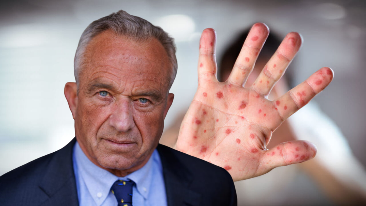 Make morbillo great again: negli Stati Uniti 2.318 casi in sette mesi, è il dato peggiore degli ultimi trentacinque anni